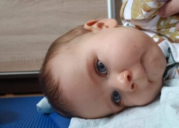 Pola opuściła OIOM, ale&nbsp;nadal przebywa w&nbsp;szpitalu