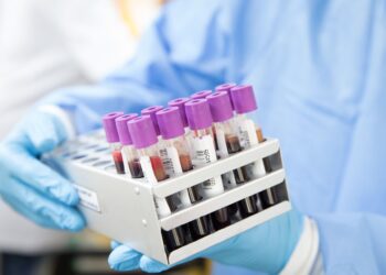 Pilnie potrzeba krwi 0 Rh&nbsp;minus