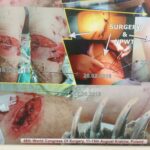 W Bieszczadach niedźwiedź zaatakował mieszkańca gminy Lutowiska (zdjęcia) 8 - Polskie Radio Rzeszów W Bieszczadach niedźwiedź zaatakował mieszkańca gminy Lutowiska (zdjęcia) - Polskie Radio Rzeszów