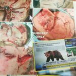 Mężczyzna zaatakowany przez niedźwiedzia prawdopodobnie za kilkanaście dni opuści szpital w Krośnie 3 - Polskie Radio Rzeszów Mężczyzna zaatakowany przez niedźwiedzia prawdopodobnie za kilkanaście dni opuści szpital w Krośnie - Polskie Radio Rzeszów