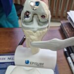 To pierwszy taki zabieg na Podkarpaciu. Pacjentce wszczepiono spersonalizowaną endoprotezę stawu kolanowego 3 - Polskie Radio Rzeszów To pierwszy taki zabieg na Podkarpaciu. Pacjentce wszczepiono spersonalizowaną endoprotezę stawu kolanowego - Polskie Radio Rzeszów