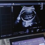 Bezpłatne badania prenatalne dostępne w Rzeszowie. Gdzie i jak skorzystać? 3 - Polskie Radio Rzeszów Bezpłatne badania prenatalne dostępne w Rzeszowie. Gdzie i jak skorzystać? - Polskie Radio Rzeszów
