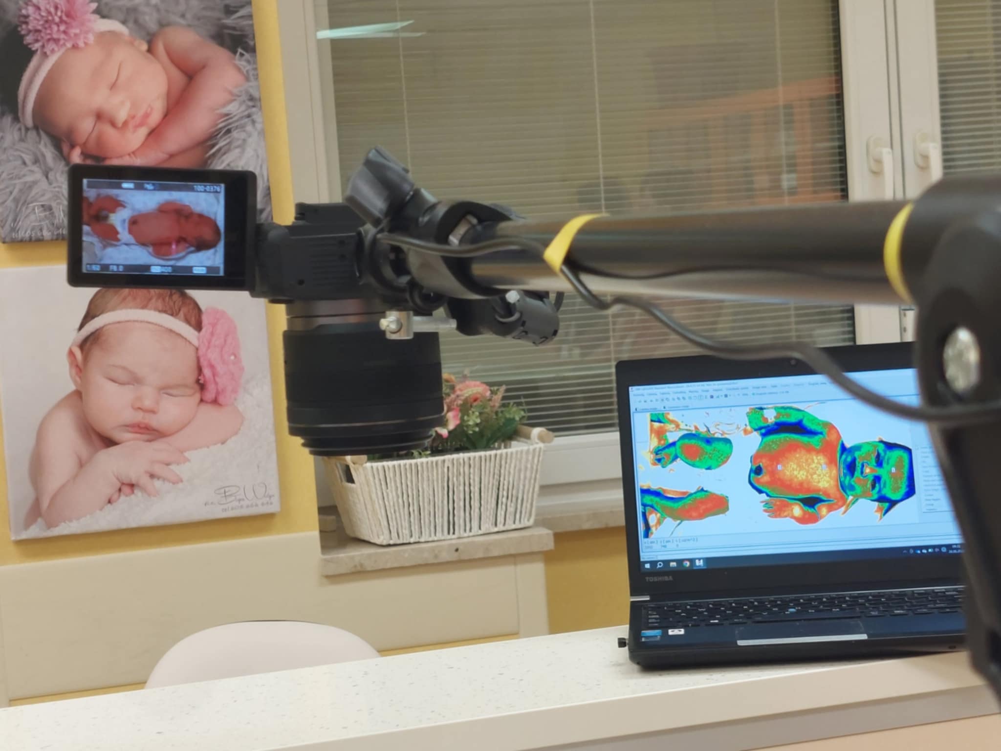 Nowatorska metoda diagnozowania żółtaczki u noworodków opracowana w Rzeszowie - Polskie Radio Rzeszów