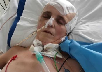 Trwa zbiórka dla Zosi z Brzyska. Po udarze walczy o powrót do sprawności