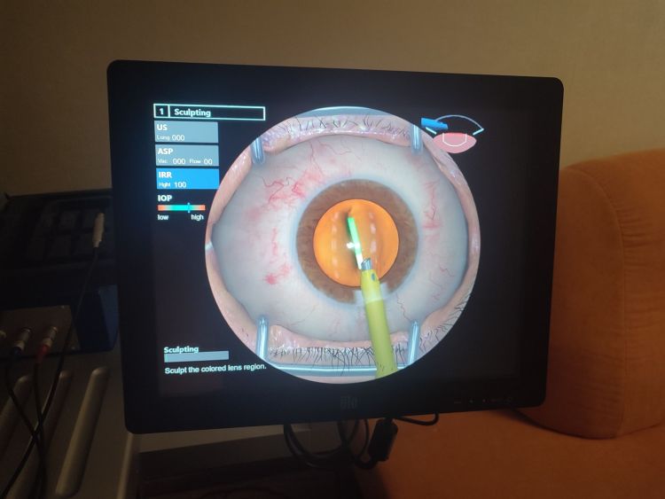 Szkolenia ukraińskich okulistów w Rzeszowie