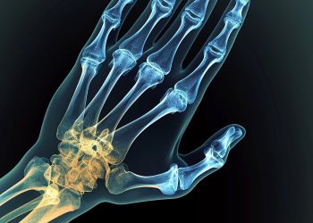 Ekspert: zabiegi wymagające zegarmistrzowskiej precyzji zmieniają oblicze ortopedii